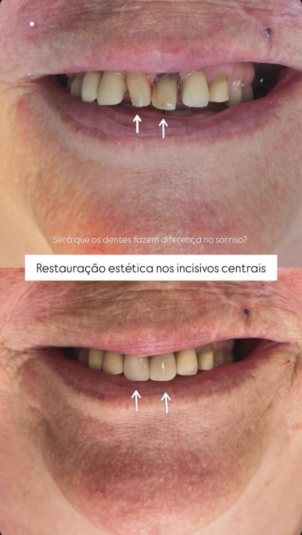 Caso 9